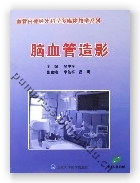 脑血管造影（CD-ROM）