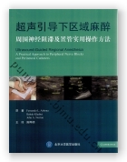 超声引导下区域麻醉——周围神经阻滞及置管实用操作方法