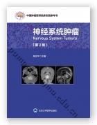 神经系统肿瘤（第2版）（中国肿瘤医师临床实践指南丛书）