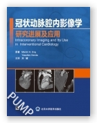 冠状动脉腔内影像学研究进展及应用