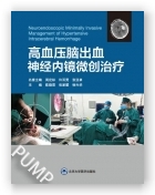 高血压脑出血神经内镜微创治疗