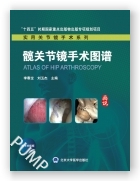 髋关节镜手术图谱